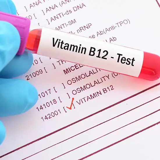 Vitamin B12 Active (Holotranscobalamin) Test
